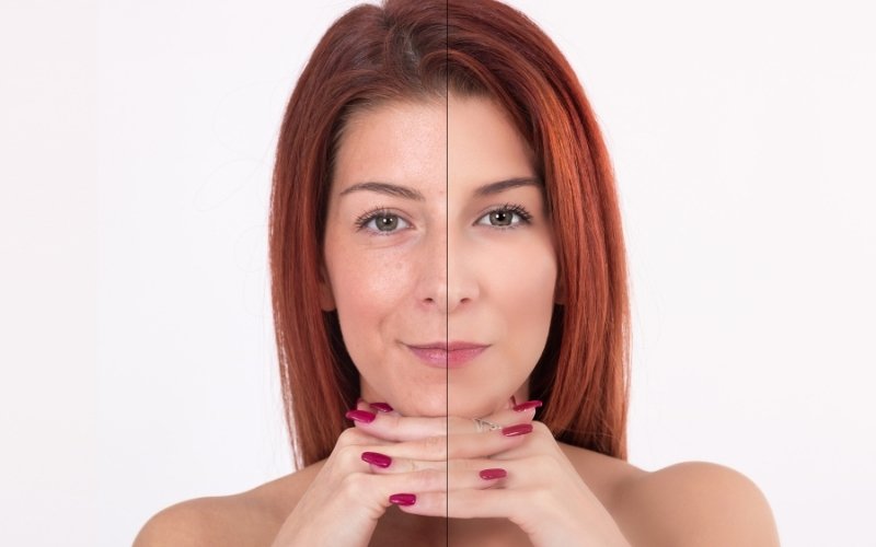 A woman’s face split in half: natural skin vs. makeup, highlighting Obagi Tretinoin benefits.