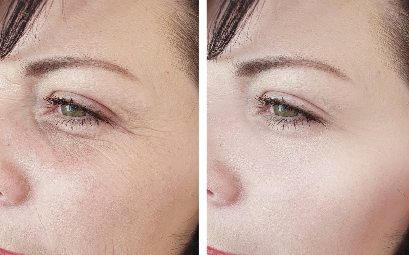Close-up of a woman's face, showing skincare benefits of C E Ferulic before and after treatment.